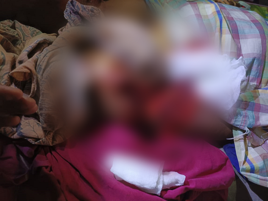 Korban saat mendapat perawatan di rumahnya di Desa Kawadang Kecamatan Taliabu Timur Selatan