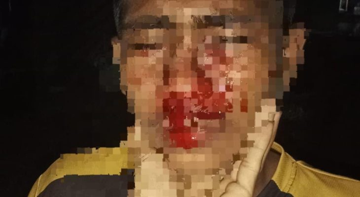 Keluarga Korban Desak Polres Halmahera Selatan Tindaklanjut Laporan Dugaan Penganiayaan 