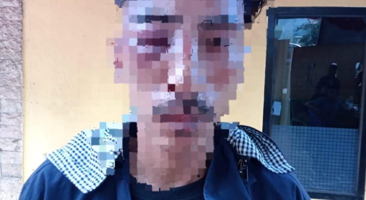 Seorang Pemuda di Ternate Dikeroyok hingga Babak Belur, Polisi Incar Pelaku