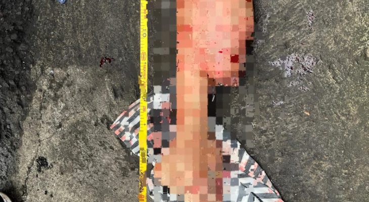Petugas Sampah di Ternate Temukan Potongan Kaki Orang Dewasa, Polisi Selidiki