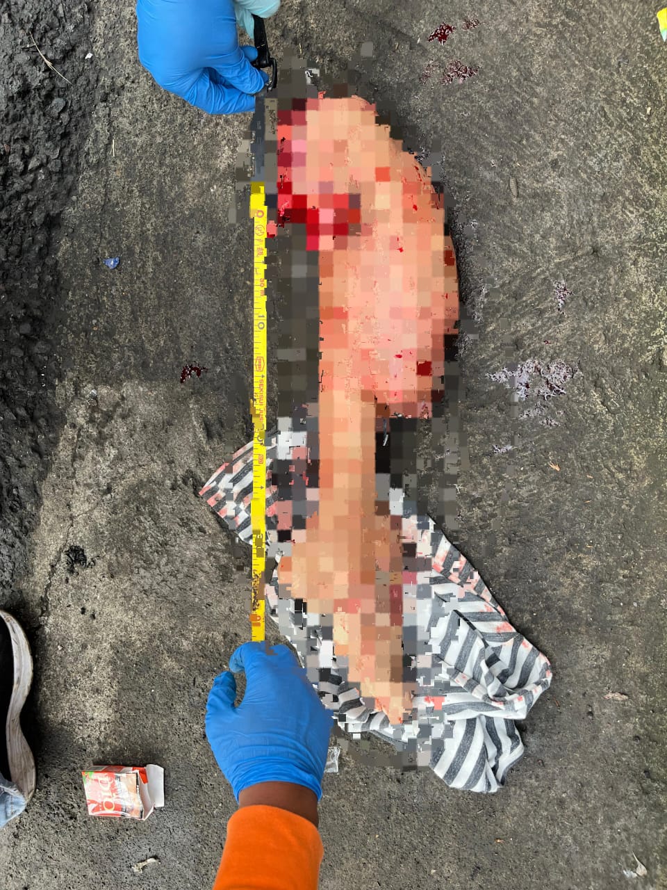Potongan kaki orang dewasa ditemukan petugas sampah.